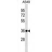 Malate Dehydrogenase 2 (MDH2) Antibody