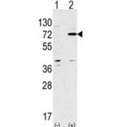 Autophagy Related Protein 7 (ATG7) Antibody