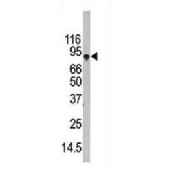 Autophagy Related Protein 7 (ATG7) Antibody
