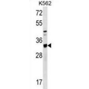 TIP41-Like Protein (TIPRL) Antibody