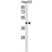 CapZ-Interacting Protein (RCSD1) Antibody
