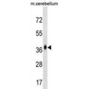 Monocyte To Macrophage Differentiation Factor 2 (MMD2) Antibody
