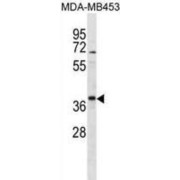 TRK-Fused Gene Protein (TFG) Antibody