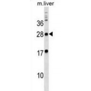 Myelin Protein Zero Like 3 (MPZL3) Antibody