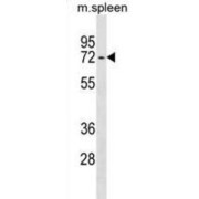 Ectonucleoside Triphosphate Diphosphohydrolase 4 (ENTPD4) Antibody