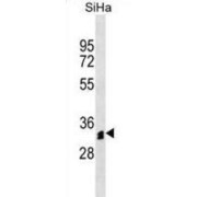 Olfactory Receptor 51M1 (OR51M1) Antibody