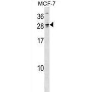 WB analysis of MCF-7 cell line lysates.