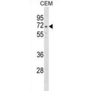 Dystrotelin (DYTN) Antibody