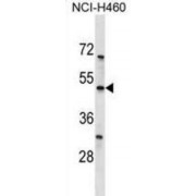 Potassium Two Pore Domain Channel Subfamily K Member 12 (KCNK12) Antibody