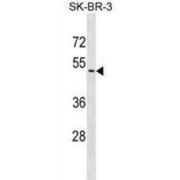 UDP Glucuronosyltransferase Family 2 Member B7 (UGT2B7) Antibody
