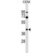 Voltage-Dependent Calcium Channel Gamma-3 Subunit (CACNG3) Antibody