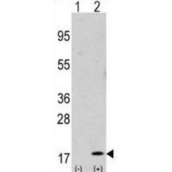 GABA-A Receptor Associated Protein (GABARAP) Antibody