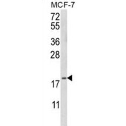 GABA-A Receptor Associated Protein Like Protein 2 (GABARAPL2) Antibody