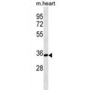 Protein Phosphatase 1 Regulatory Subunit 3B (PPP1R3B) Antibody