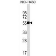 Glutamyl-tRNA (QRSL1) Antibody