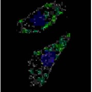 Lysosomal Associated Membrane Protein 1 (LAMP1) Antibody