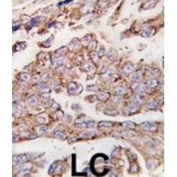 Lysosomal Associated Membrane Protein 1 (LAMP1) Antibody