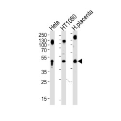 Lysosomal Associated Membrane Protein 1 (LAMP1) Antibody