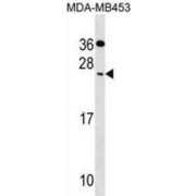 abx030135