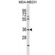 E3 Ubiquitin-Protein Ligase RNF217 (RNF217) Antibody