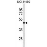 Sphingosine-1-Phosphate Phosphatase 2 (SGPP2) Antibody