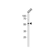 Zinc Finger With KRAB And SCAN Domains 4 (ZKSCAN4) Antibody
