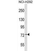 abx030149