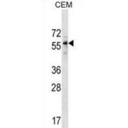 Diphthamide Biosynthesis Protein 2 (DPH2) Antibody