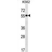 FERM Domain-Containing Protein 8 (FRMD8) Antibody