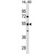 Nucleosome Assembly Protein 1-Like 2 (NAP1L2) Antibody