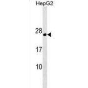 Plasmolipin (PLLP) Antibody