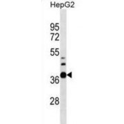 RNA Pseudouridylate Synthase Domain-Containing Protein 1 (RPUSD1) Antibody