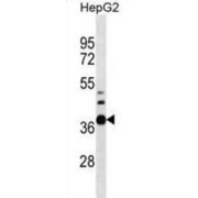 RNA Pseudouridylate Synthase Domain-Containing Protein 1 (RPUSD1) Antibody