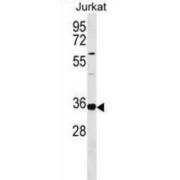 tRNA Selenocysteine 1-Associated Protein 1 (TRNAU1AP) Antibody