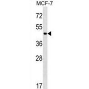 Zinc Finger And BTB Domain-Containing Protein 12 (ZBTB12) Antibody