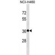 GS Homeobox 2 (GSX2) Antibody