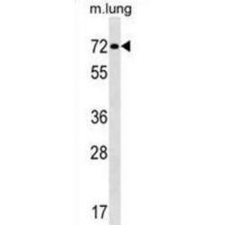 Transcription Factor Binding To IGHM Enhancer 3 (TFE3) Antibody
