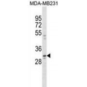 Coiled-Coil Domain Containing 28A (CCDC28A) Antibody