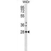 THAP Domain Containing 10 (THAP10) Antibody