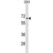 Coiled-Coil Domain-Containing Protein 151 (CCDC151) Antibody