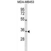 Osteopetrosis-Associated Transmembrane Protein 1 (OSTM1) Antibody