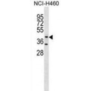 Glycosyltransferase 8 Domain-Containing Protein 1 (GLT8D1) Antibody