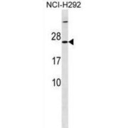 Mitochondrial Ribosomal Protein S23 (MRPS23) Antibody