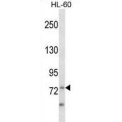 Zinc Finger And BTB Domain-Containing Protein 39 (ZBTB39) Antibody
