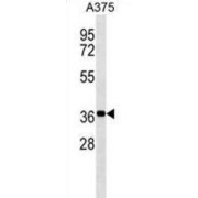 Non-Structural Maintenance of Chromosomes Element 1 Homolog (NSMCE1) Antibody