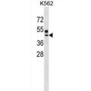 Zinc/RING Finger Protein 4 (ZNRF4) Antibody