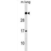 N-Acetyltransferase 15 (NAT15) Antibody