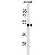 Nuclear RNA Export Factor 5 (NXF5) Antibody