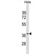 OCIA Domain-Containing Protein 1 (OCIAD1) Antibody