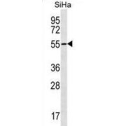 Ring Finger Protein 150 (RNF150) Antibody